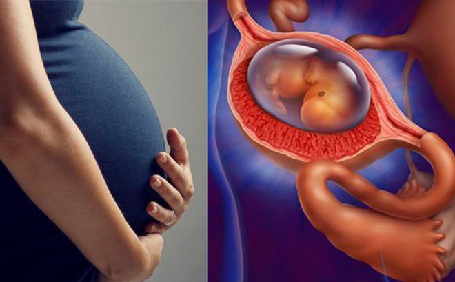 Những lưu ý khi mang thai ngoài tử cung