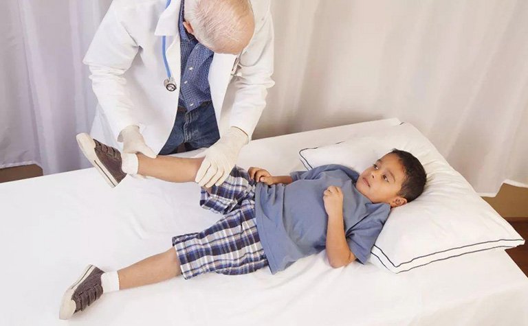  Điều trị viêm khớp ở trẻ em
