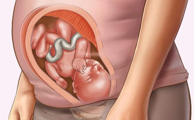 Phát hiện kịp thời dị tật bẩm sinh ở thai nhi