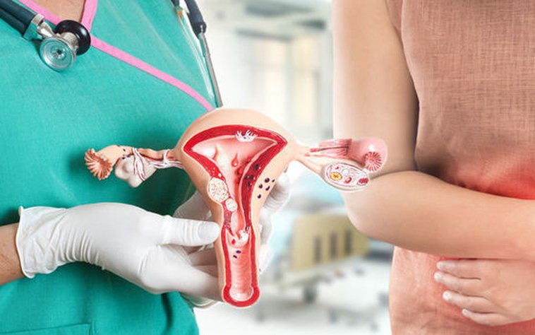 Bệnh lạc nội mạc tử cung và các biện pháp điều trị