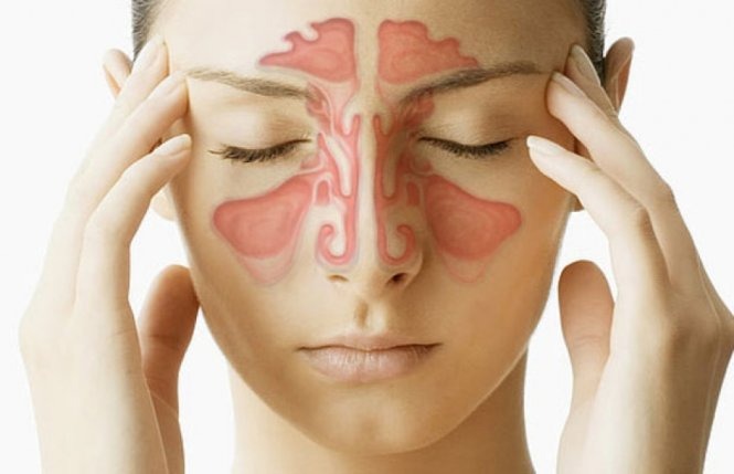 Cách nhận biết và điều trị bệnh viêm mũi xoang