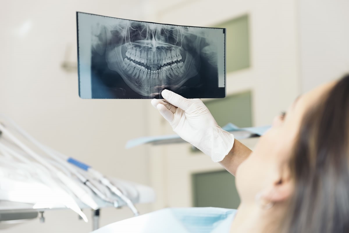 Những trường hợp nên hoặc trì hoãn việc thẩm mỹ răng
