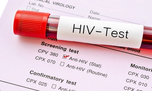 Những lợi ích từ việc xét nghiệm nhiễm mới HIV