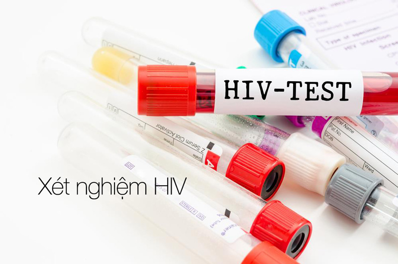 HIV: Phát hiện sớm điều trị kịp thời có ý nghĩa vô cùng quan trọng